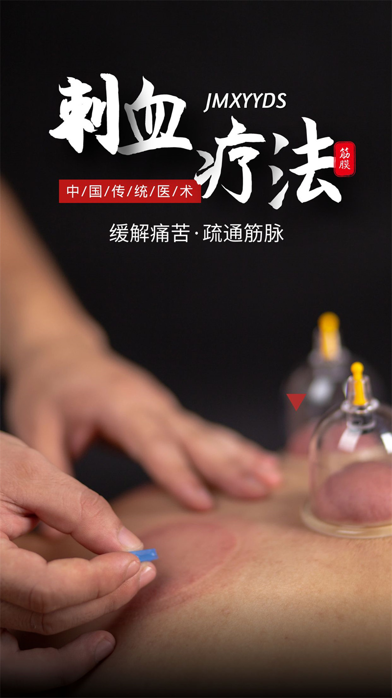 中医科刺血疗法